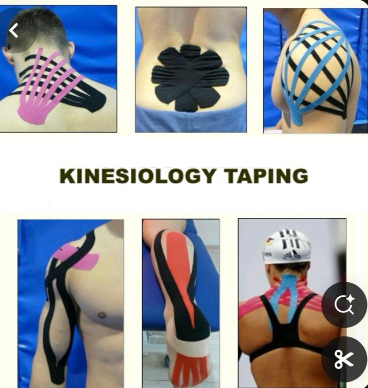 bande de kinesiologie 5cm*5m شريط العلاج الحركي