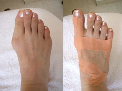 bande de kinesiologie 5cm*5m شريط العلاج الحركي